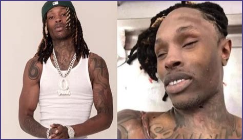 Unseen Autopsy Images Of King Von: The Tragic Aftermath Revealed